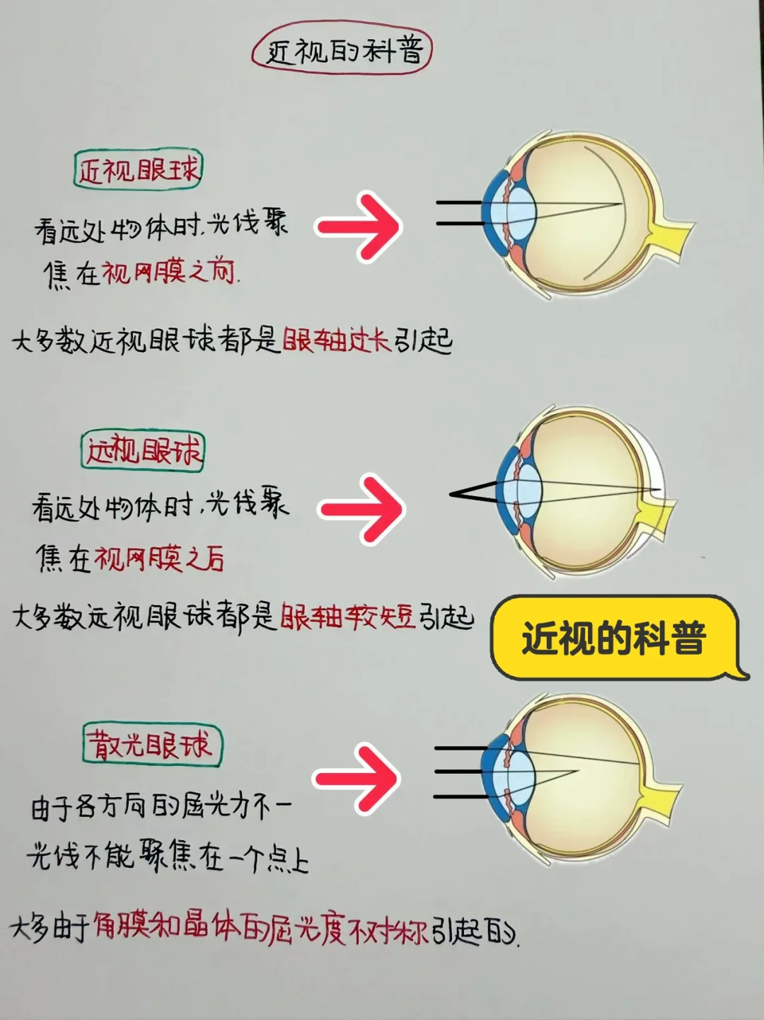 今日学习打卡—近视防控&低浓度阿托品滴眼液