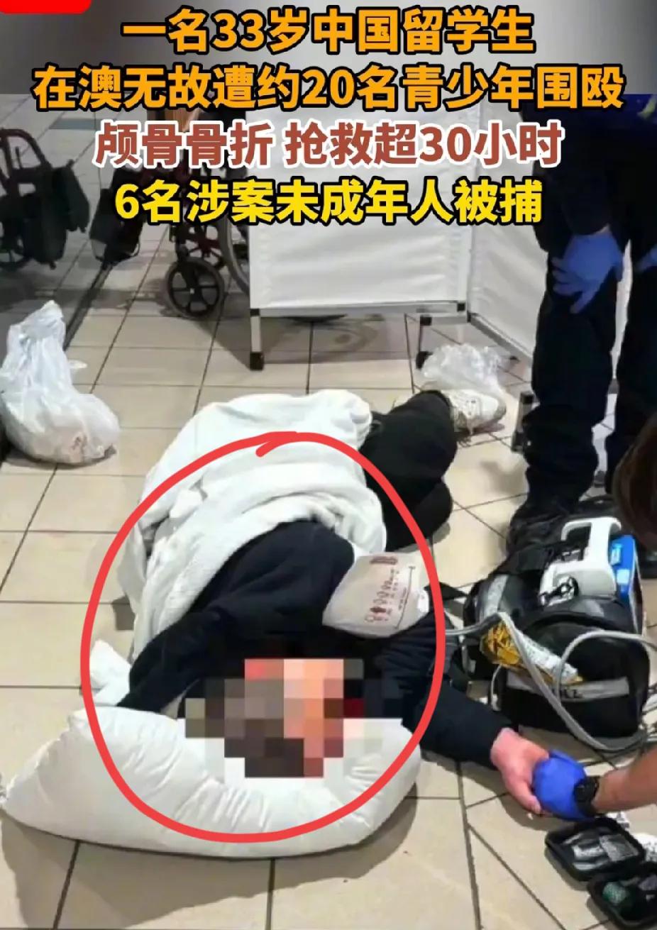 “太气人了”！男留学生在澳遭20名青少年围殴，造成颅骨骨折，抢救超30小时，6名