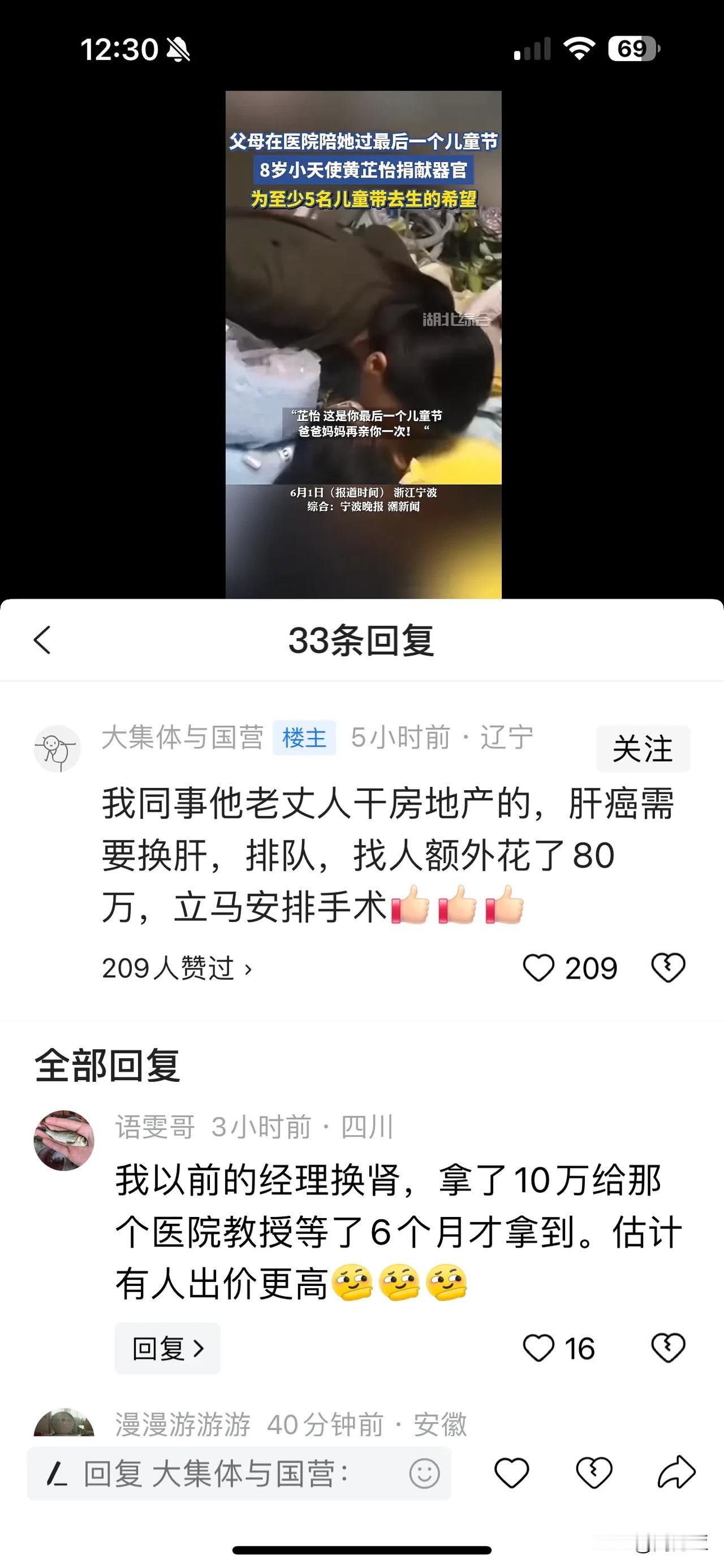多花80万就可以立马换器官，这是真的假的？


一个网友说，他同事的岳父是干房地