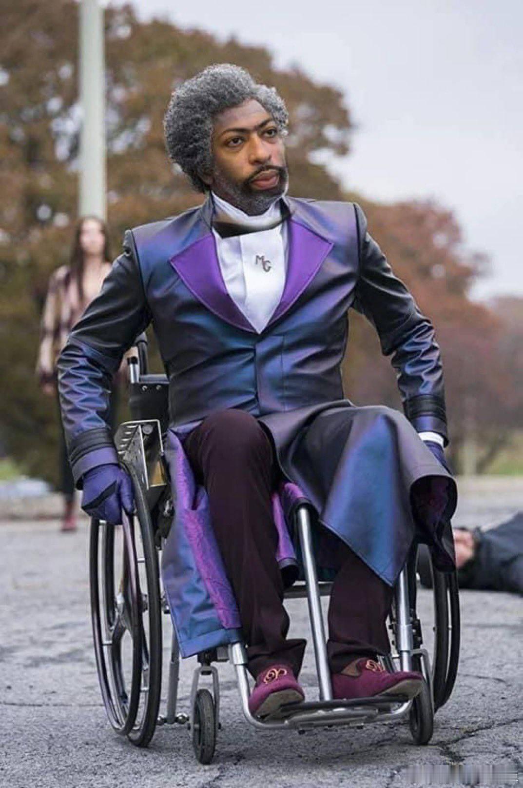 NBA 浓眉实在是太玻璃人了！浓眉受伤