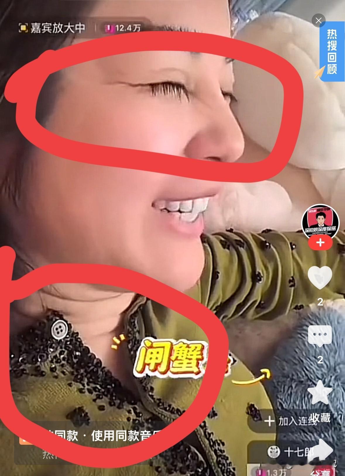 于老太的侧颜没个看了，满脖子都是大褶子，眼角鱼尾纹那么深，一看就是老太太。^_^