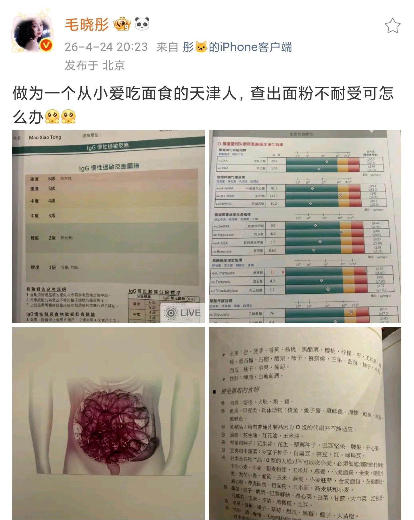 曝毛晓彤凌晨从医美诊所离开 好刚的回复！！ 
