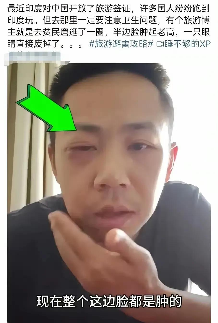 脑袋不要发热一窝蜂，去印度旅游，不是看钱包允许不允许，而是看身体素质允许不允许。