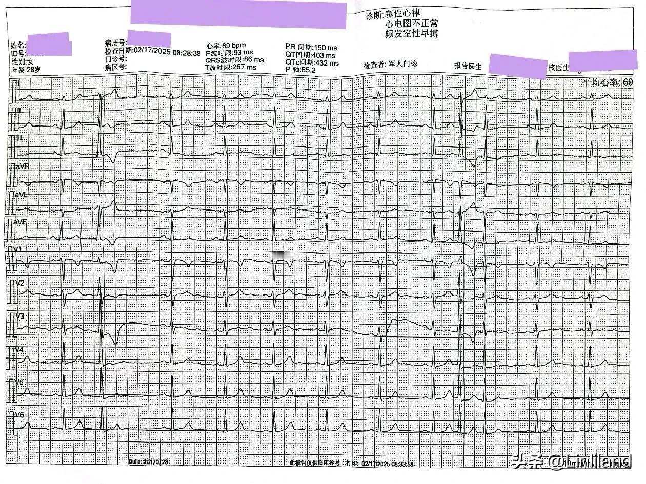 女性患者，28岁，心电图及动态心电图发现“室早”来诊。从动态心电图检查结果来看，