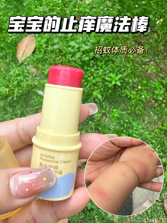 后悔没早点发现这款招蚊体质必备的紫草膏