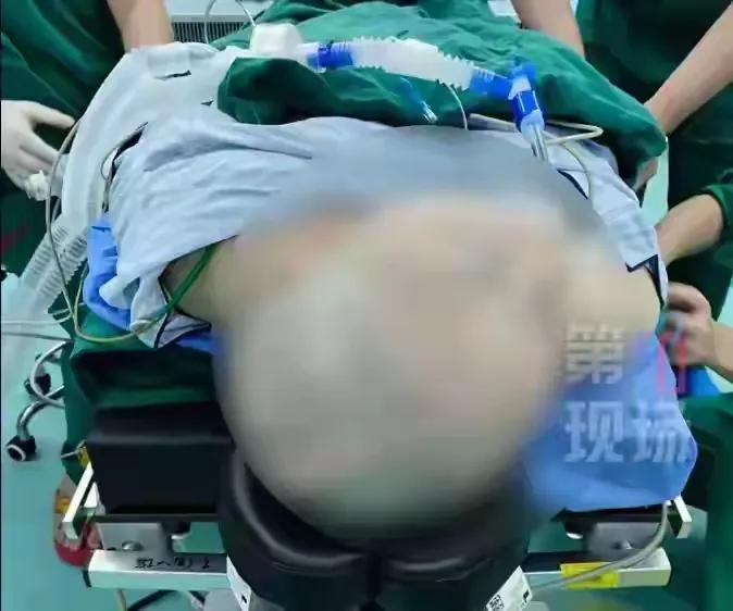 深圳一位独居的45岁女子，竟在睡梦中与死神擦肩而过。这并非天灾，而是日积月累的生