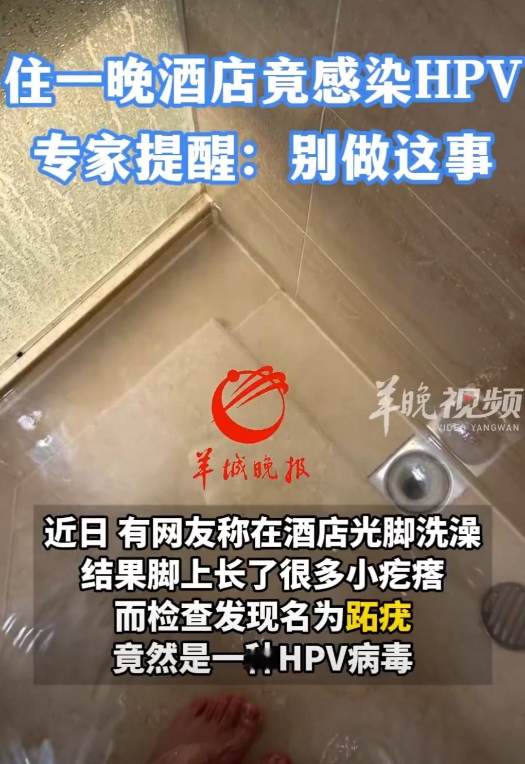 网友住酒店光脚洗澡感染HPV好吓人，过去住酒店一直都是光脚洗澡，看来以后还得自带