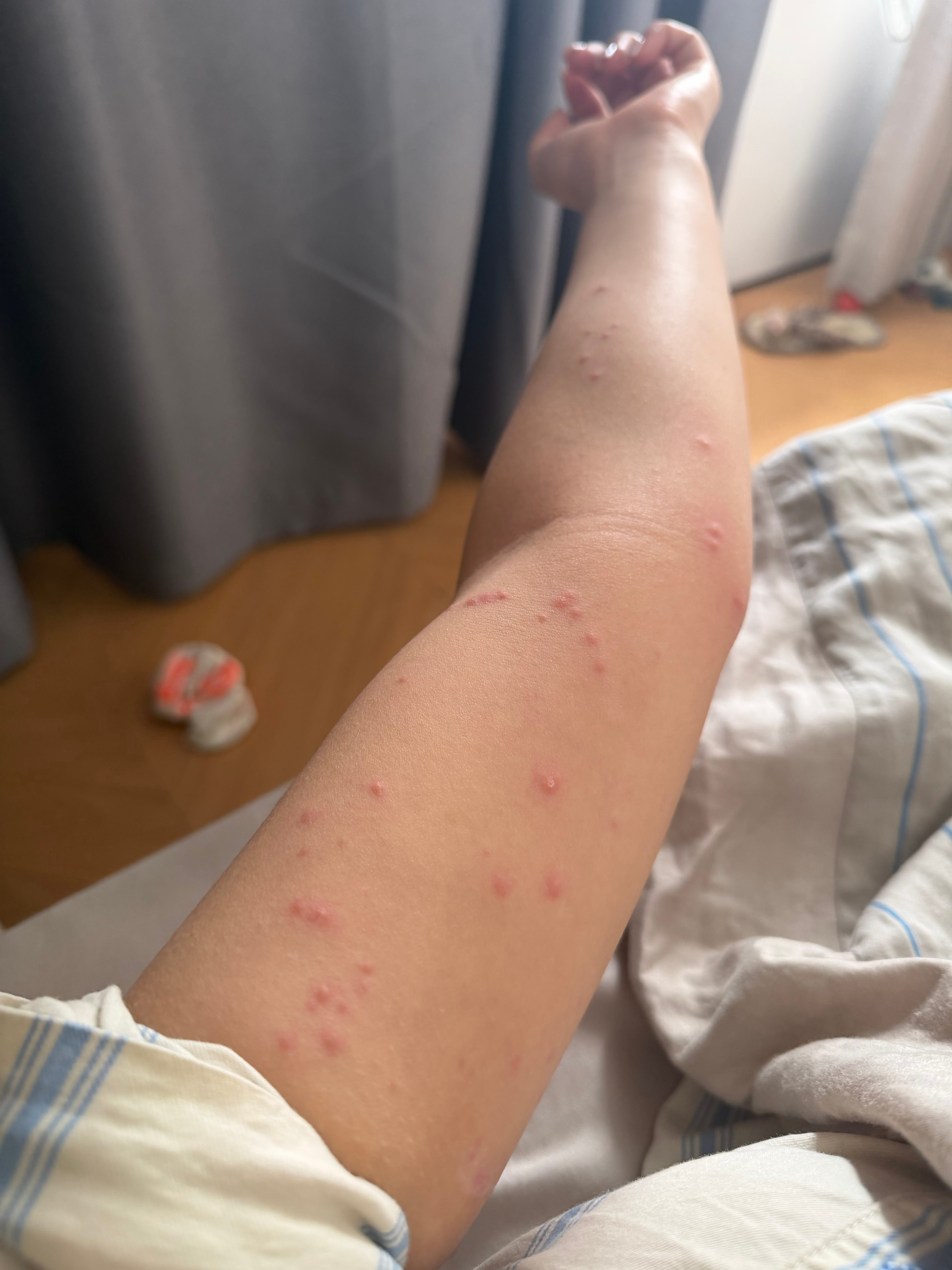 咖喱吧跳蚤藏身上自己没被咬 给他梳毛的人遭殃了 