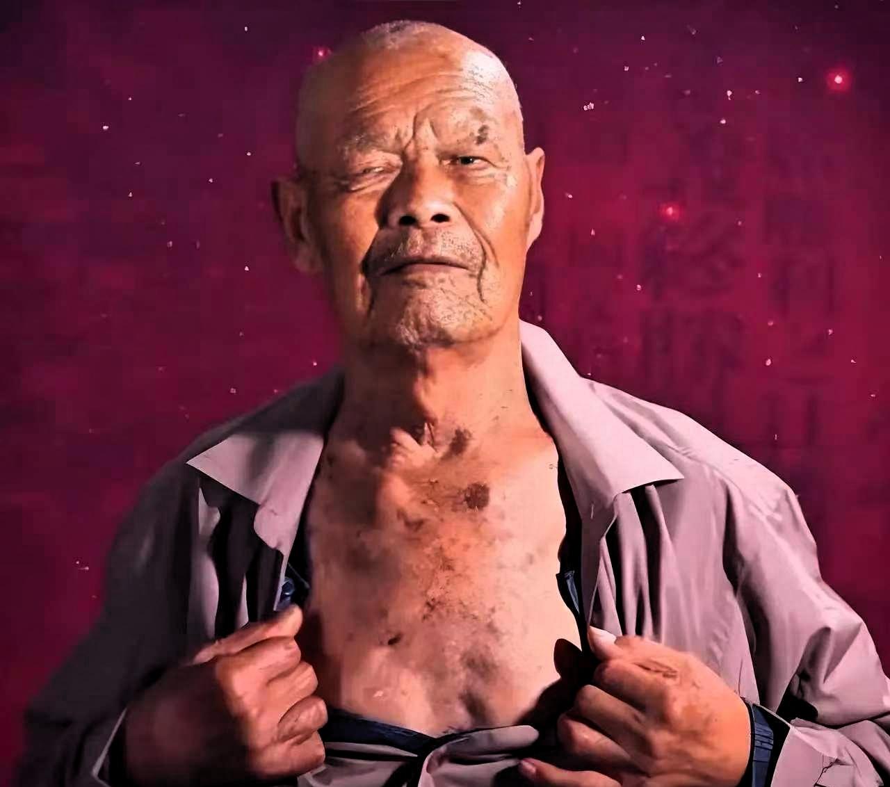 一个山东大哥，咳嗽了十年。某天在地里干活，咳得惊天动地，突然"哇"一声，从嘴里喷