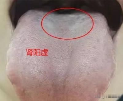 你到底是肾阳虚，还是肾阴虚？别再瞎蒙了，教你一分钟自测
肾虚分为肾阳虚和肾阴虚，