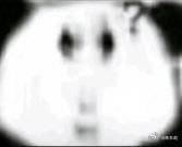 男子因彩礼轻生父母索赔20万直到现在 还有很多人认为彩礼是捆绑家庭的重要原因 ​