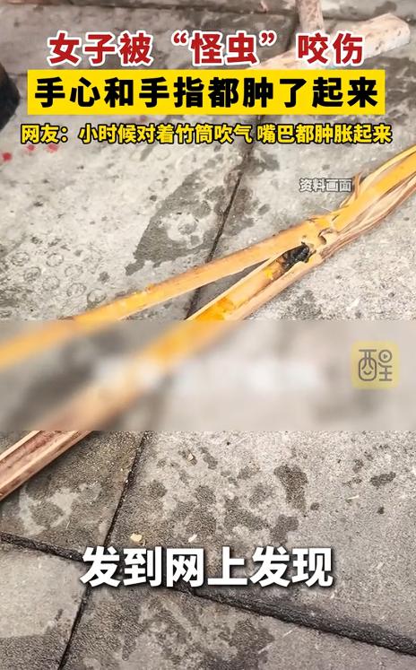 万万没想到！四川雅安，一位女子在家里扫地时，竟被扫把柄里窜出的一只“怪虫”狠狠咬