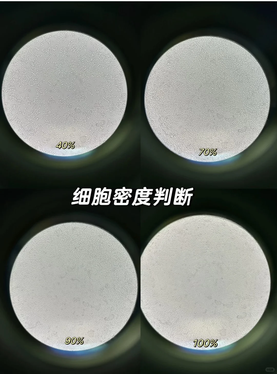 镜下怎么判断细胞密度❓