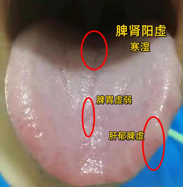 ”欲望低“，“敏感易泄”，“时间短”，补阳没效果，用右归丸、桂附地黄丸都没用！
