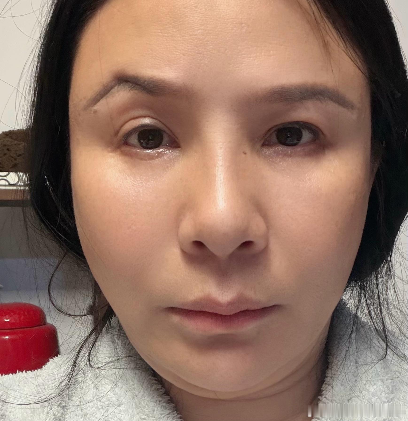 我最近因为做筋膜拉伸复位（关于这个，我已经算个达人了），我会随时随地自拍脸部的动