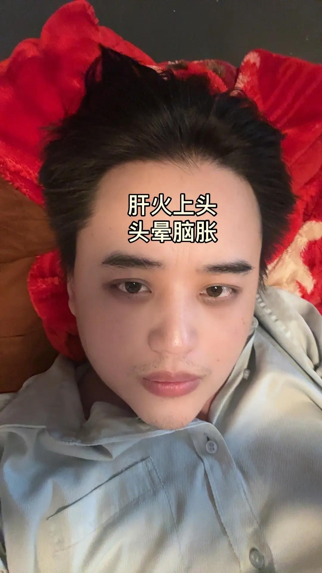 我开了磨皮，不然没法看我的黑眼圈……胸口有气压，长时间心结打不开今天头胀 ……半