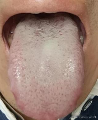 失眠火大、尿频尿急！中医教你1招：清心火+温肾阳，增添肾动力！
这位粉丝，时常感