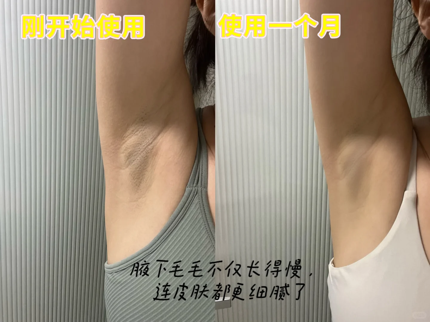 答应我！都去入Ulike脱毛仪 ！