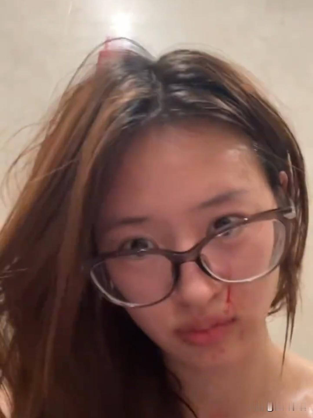 韩安冉，助理被打！

7月17日晚，网红韩安冉的助理在直播时称，自己被韩安冉前男
