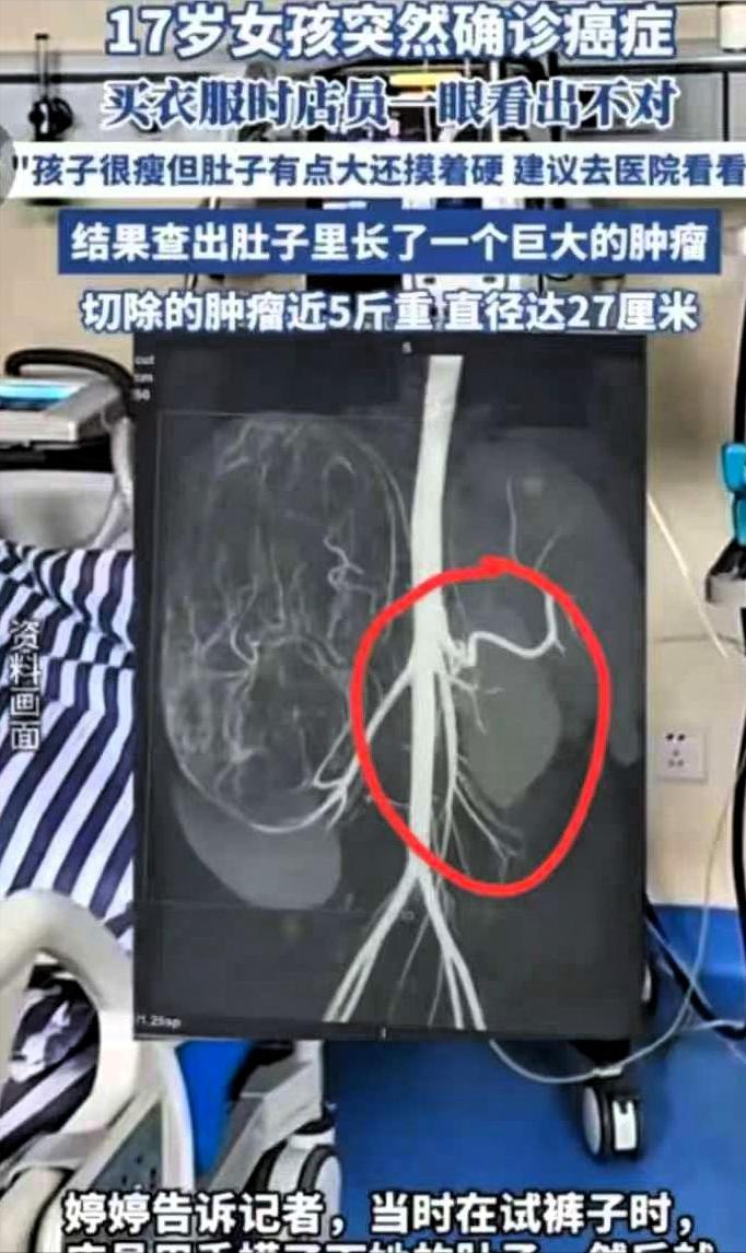 2025年6月，广东17岁女孩和妈妈一起逛街买衣服，在试裤子的时候，老板娘发觉女