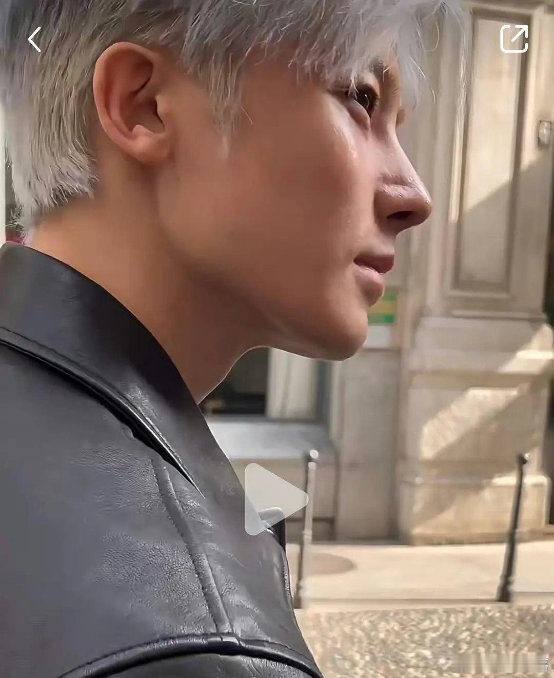 侯明昊的鼻子怎么了？好吓人。 