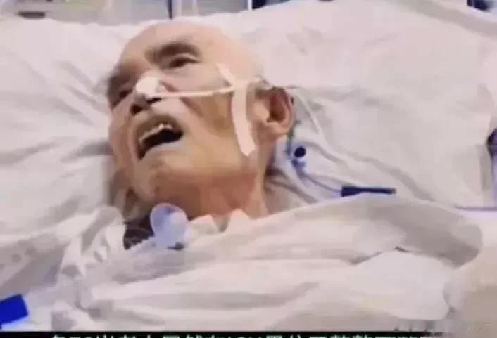 一位76岁的老人，已经在ICU里待了4年，身上插满了各种管子，只有眼睛能动。

