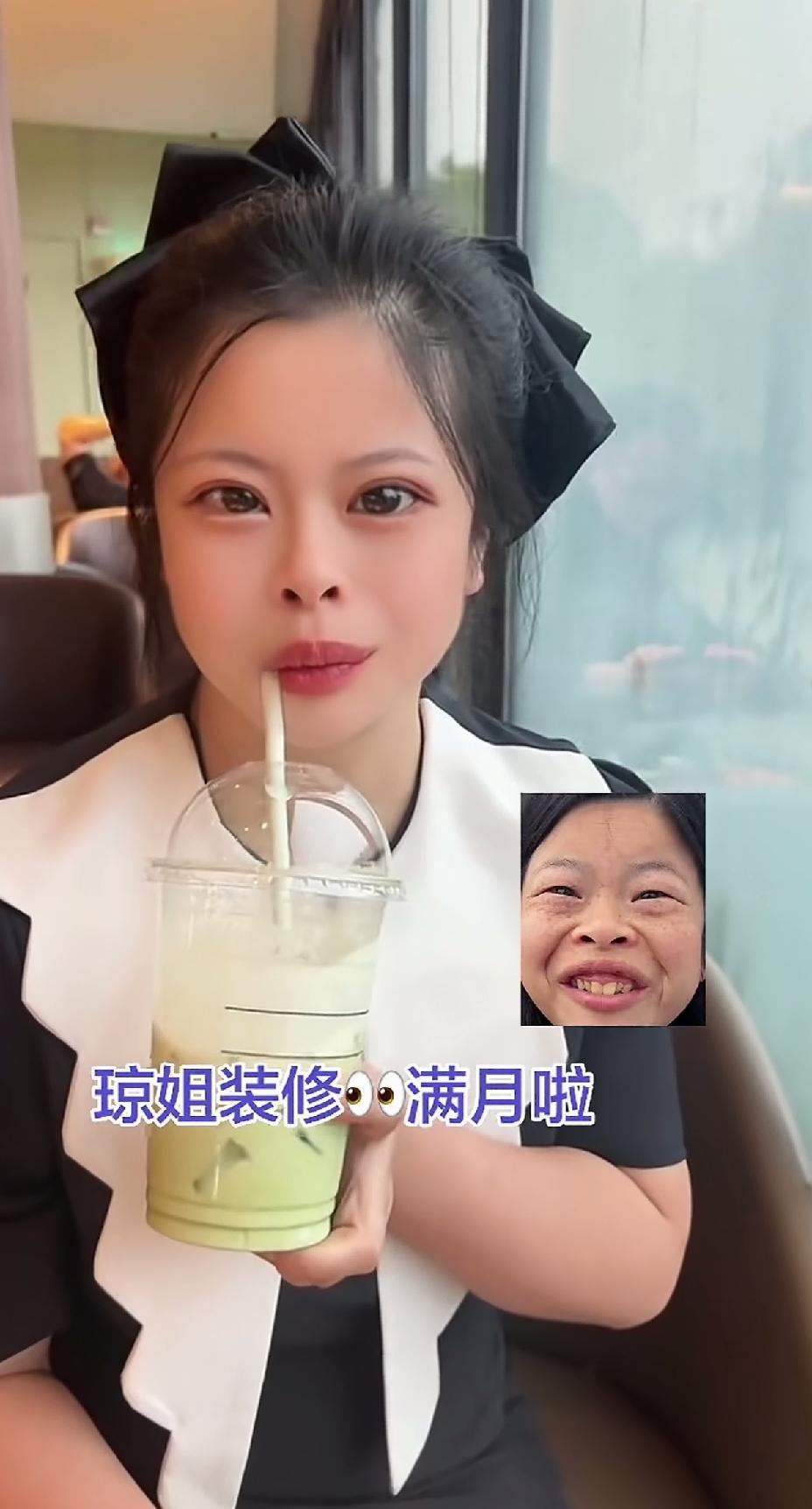 网红琼姐整容太成功了，曾经有多丑，如今就有多美，美的都快不像一个人。