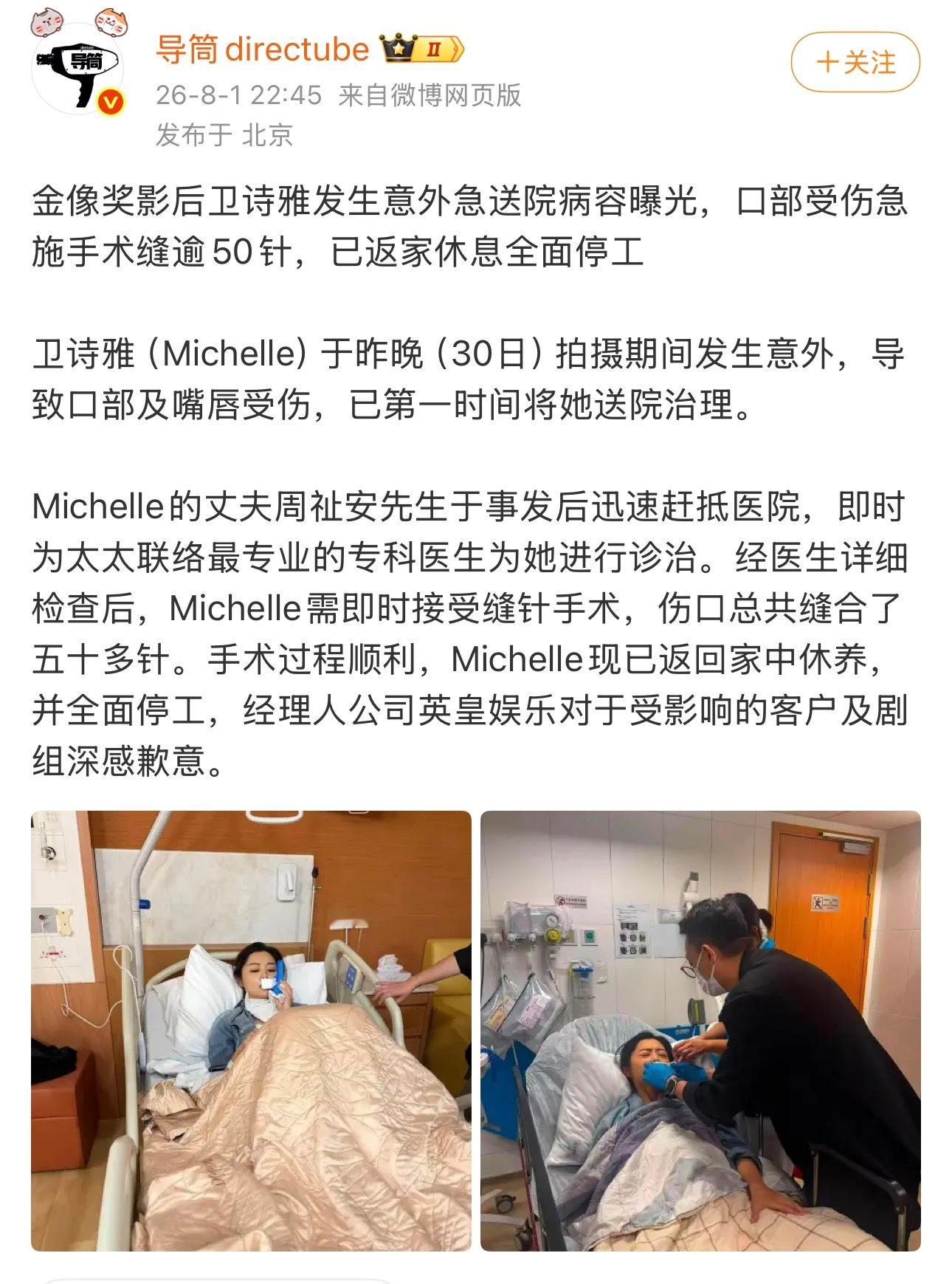 “口部受伤急施手术缝逾50针” 那不是堪比毁容？而且会对做表情有影响吧