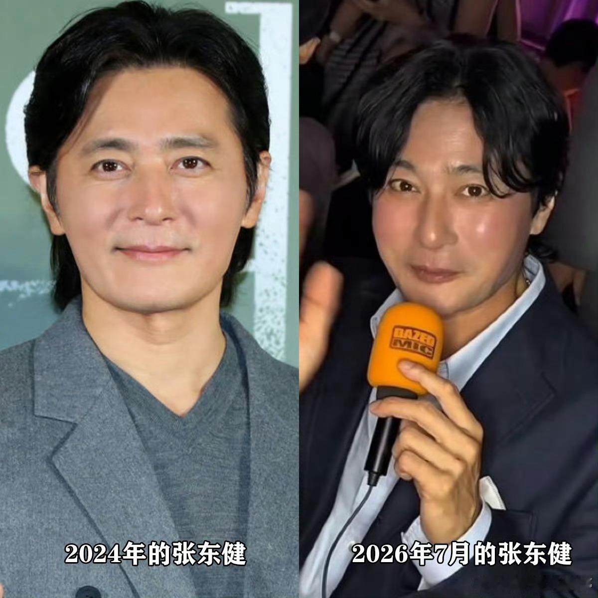 至今不能理解张东健中途去削骨，然后到老了，其实脸就会挂不住肉，然后再折腾，现在成