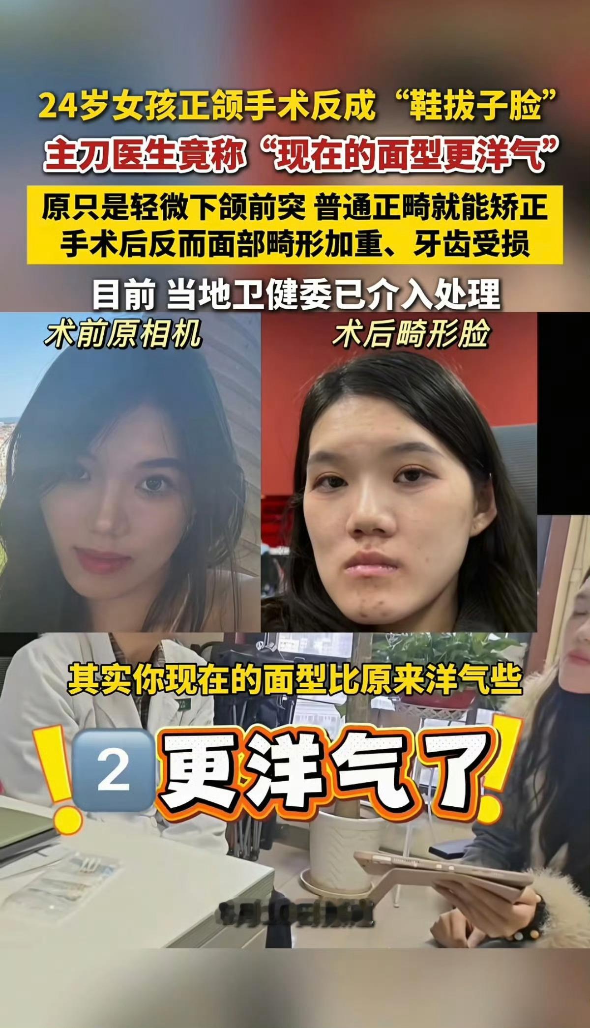 医生回应女孩正颌手术做反了爱美之心人皆有之，但是微整这种手术还是要去正规权威的医