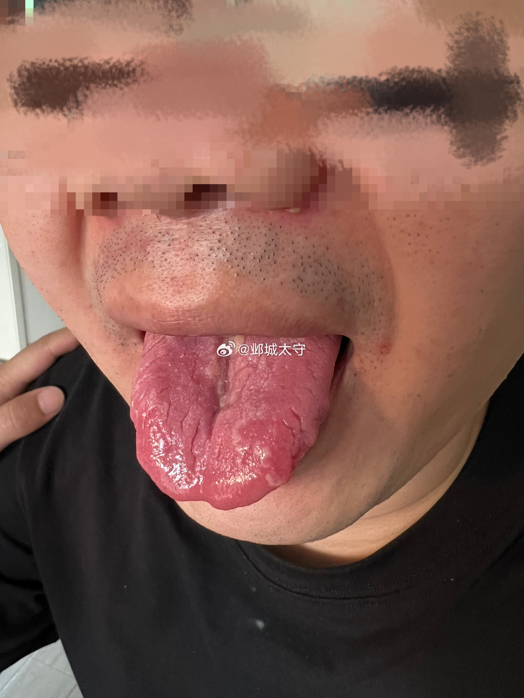 睡眠不好，这种舌阁下当如何应对？ ​​​
