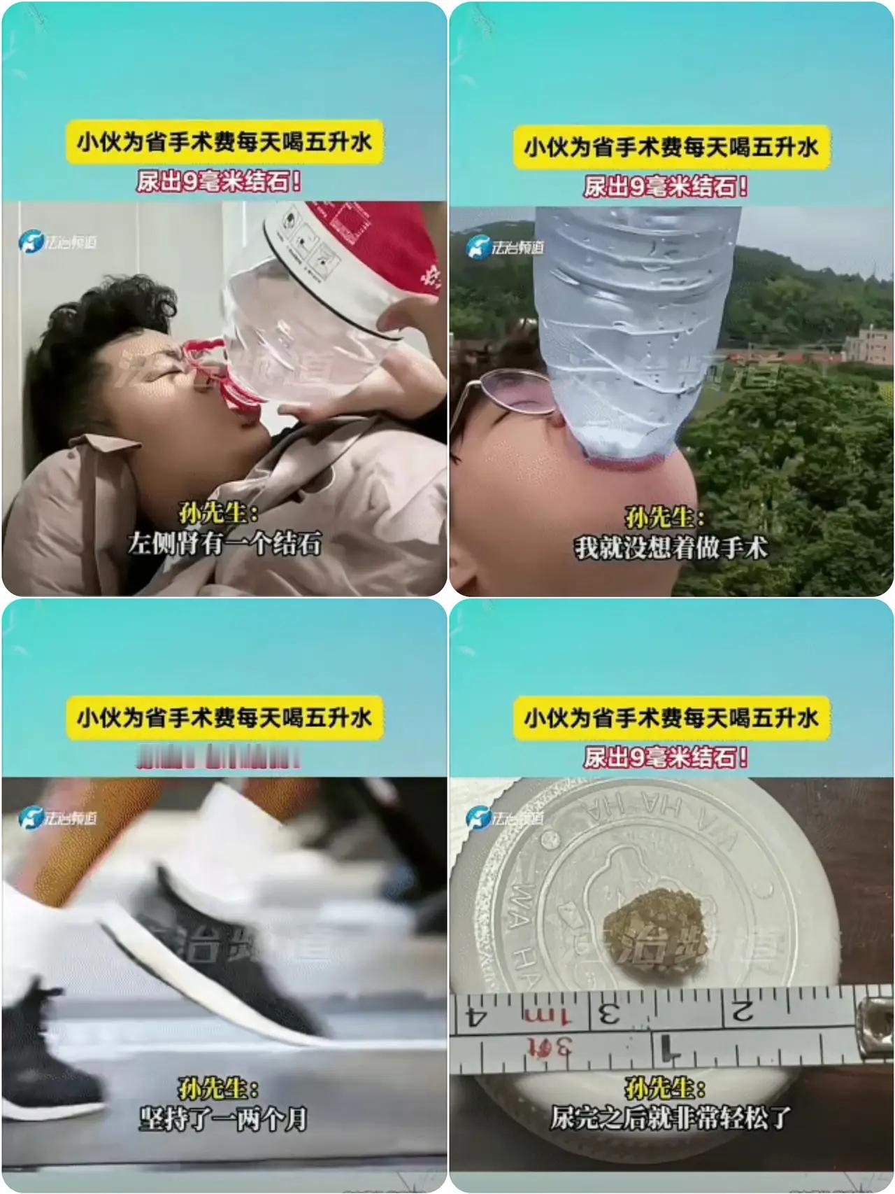 孙先生的狠劲真让人佩服！
查出肾结石，听到手术费一万多，他直接放弃手术，每天硬灌