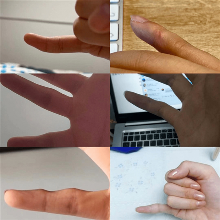 现在躺在床上刷手机的你，是不是正用小拇指托着手机底座？✋ 快看看你的小拇指内侧，