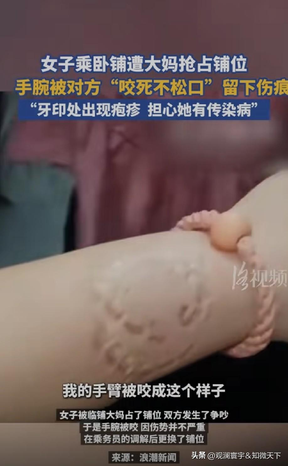 被咬了，是不是要去打疫苗啊[捂脸]