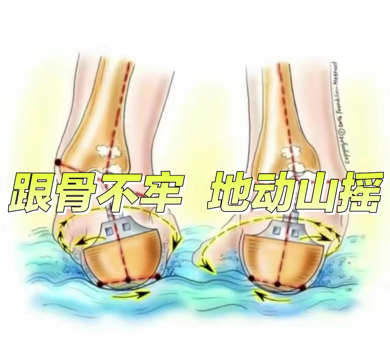 跟骨不牢 地动山摇