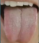 下午继续，伸舌我看！全程不收费！一个不漏，1分钟告知病因和调理方向！[鼓掌][鼓