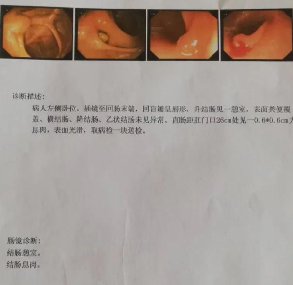 养肠就是养健康，做好三点护好肠道。
为什么说养肠就等于养健康呢？其实答案很简单，