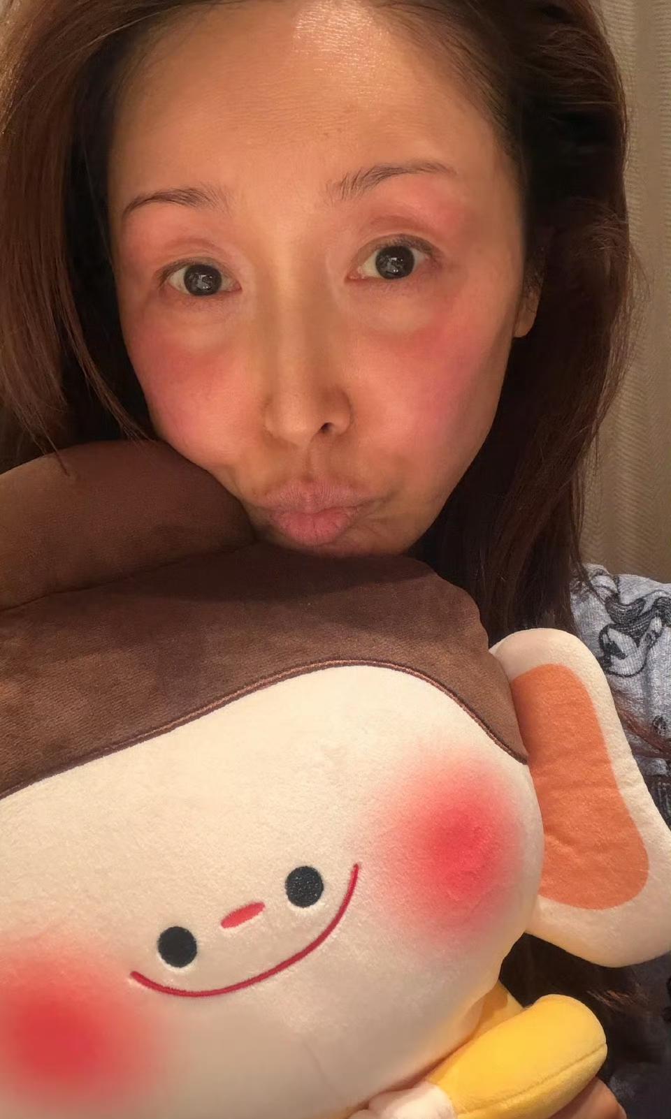 最近几天有多冷，看歌手孙悦在山西大同录春晚脸都被冻伤了就知道有多冷了，孙悦脸颊和