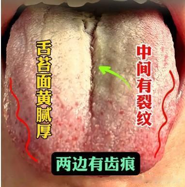 刚23岁小伙子，欲望强的可怕，每天都得来 经常一天两三次[捂脸][捂脸][捂脸]