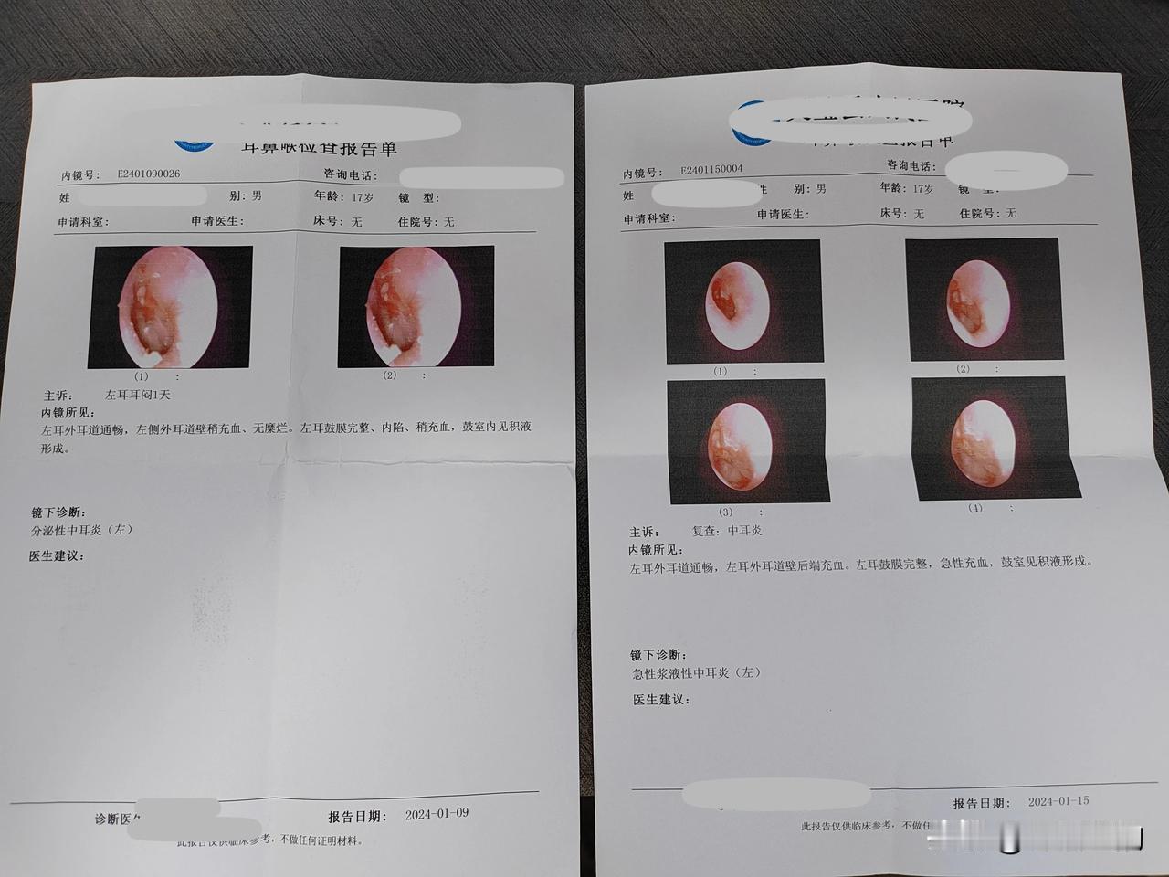 紧急在线求助。
谁能告诉我，中耳炎有什么好的方法。
儿子高三，正值关键时候。谁知
