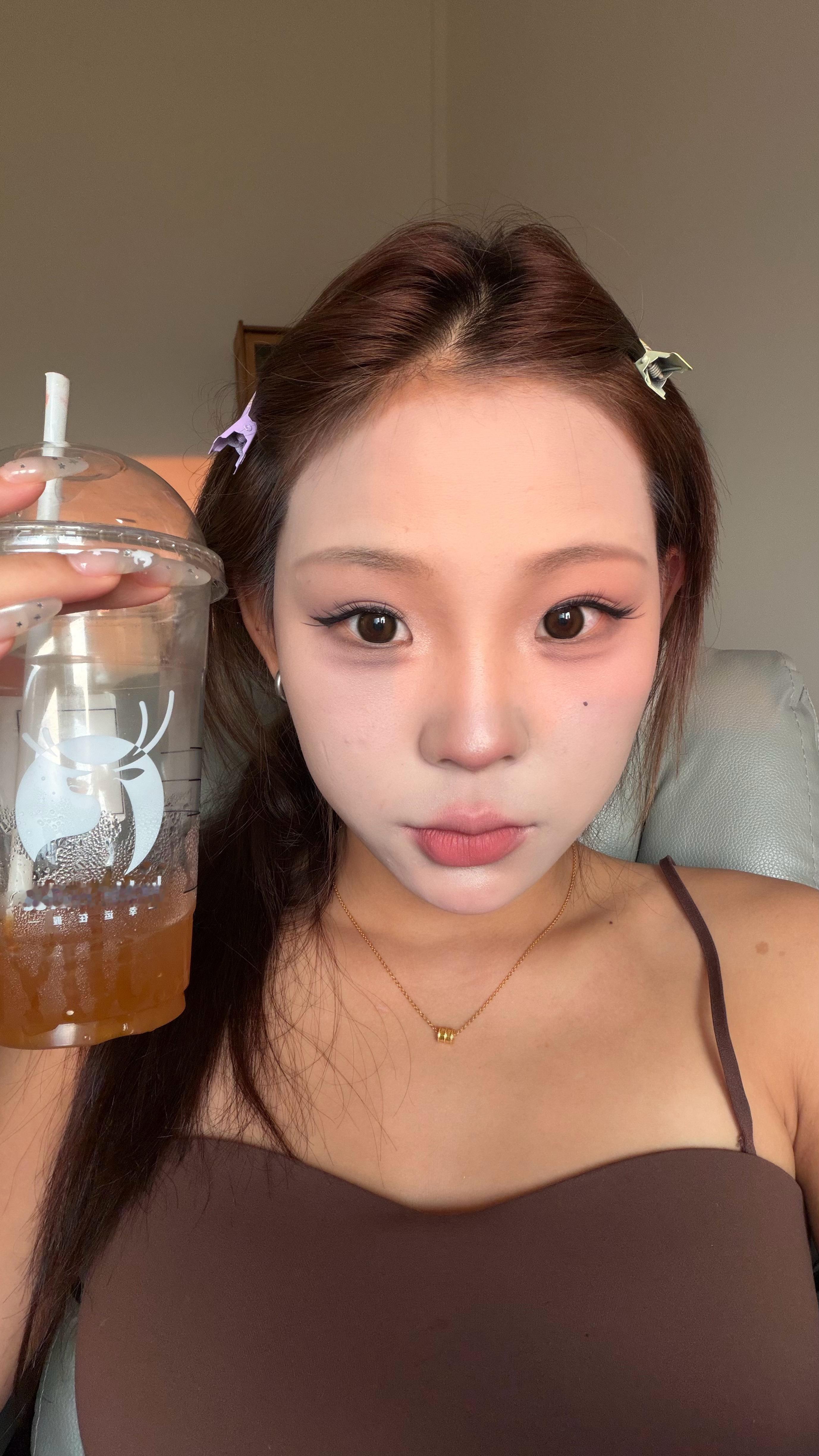 贪吃王来了 这个脸肿的牙都张不开 今天中午依旧能炫一锅麻辣烫 难受死我了  嘴都