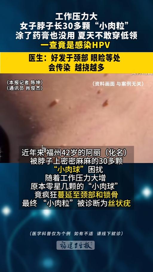 “这东西到底需不需要治？”6月3日报道，福建，一女子脖子上长了小肉粒，好几年都消