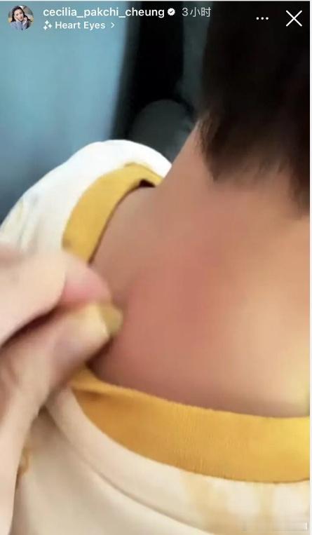 张柏芝为小儿子做保健，7岁张礼承头发乌黑浓密，母子用中文交流 ​​​