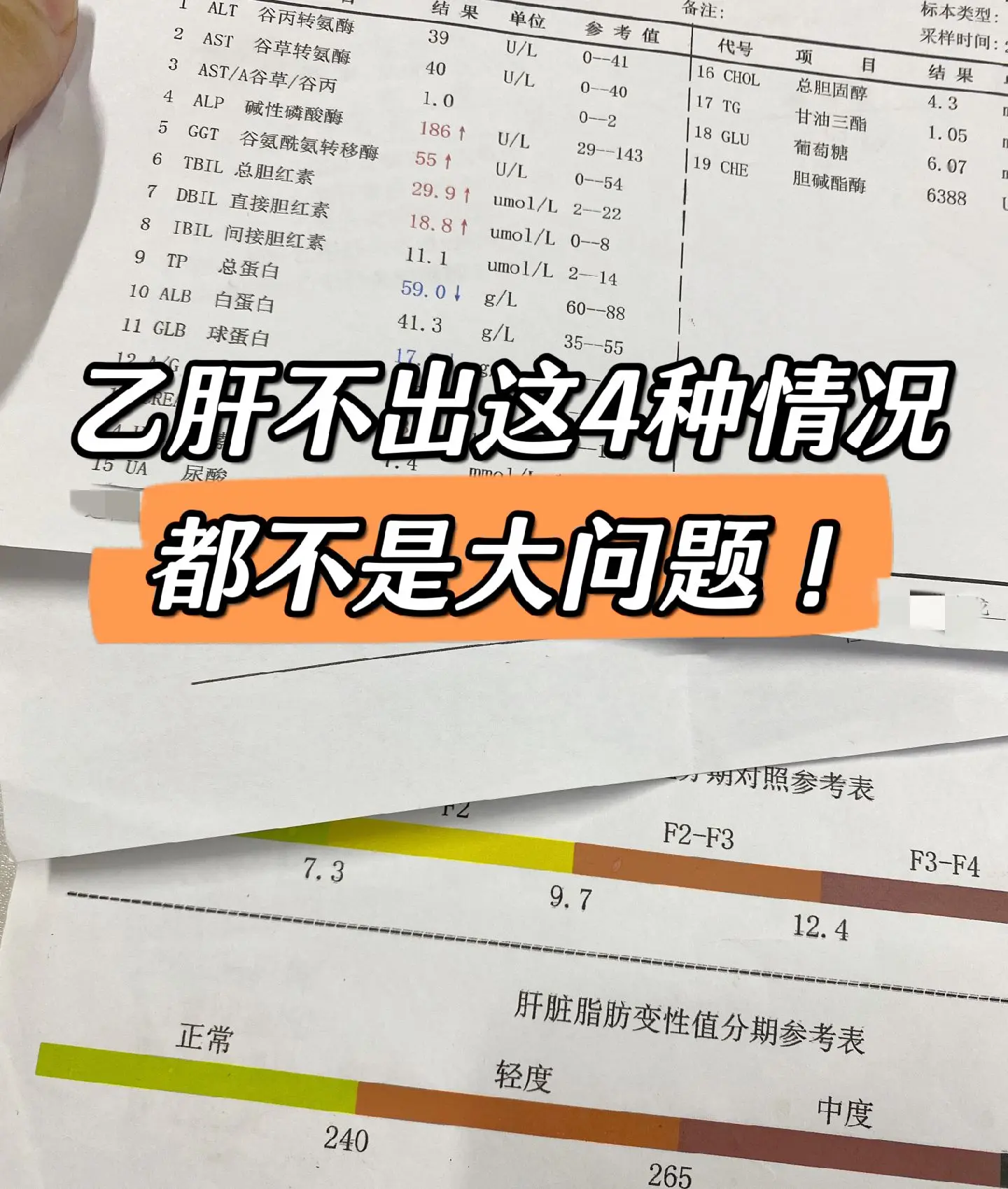 乙肝患者不出现这4种情况，都不是大问题！第一：胆红素升高2倍以上＞28...