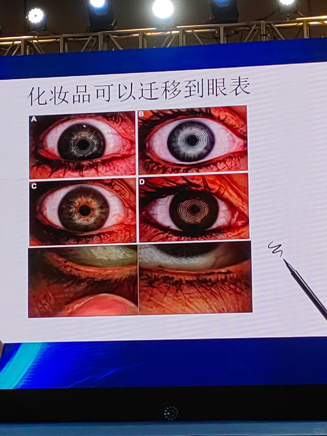 化妆后，你卸妆卸干净了吗