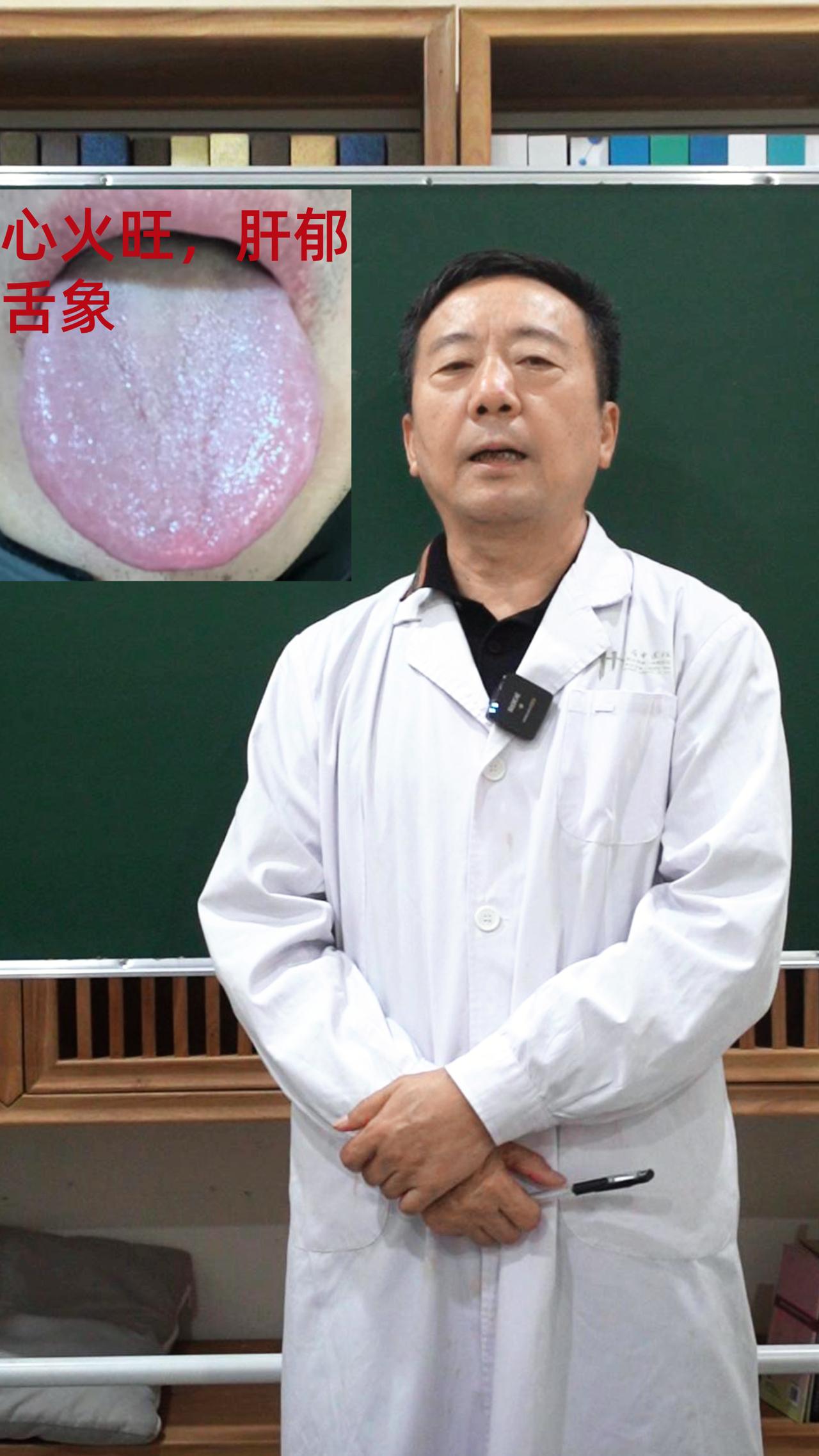 今天不忙，争取看够88个舌头之前没看过的今天可以继续发了，看过的就先停吧，给没看