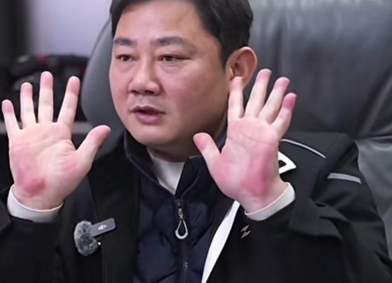 4月3日，“手掌太红大批网友提醒张雪及时就医”登上热搜引热议，据大象新闻报道，“