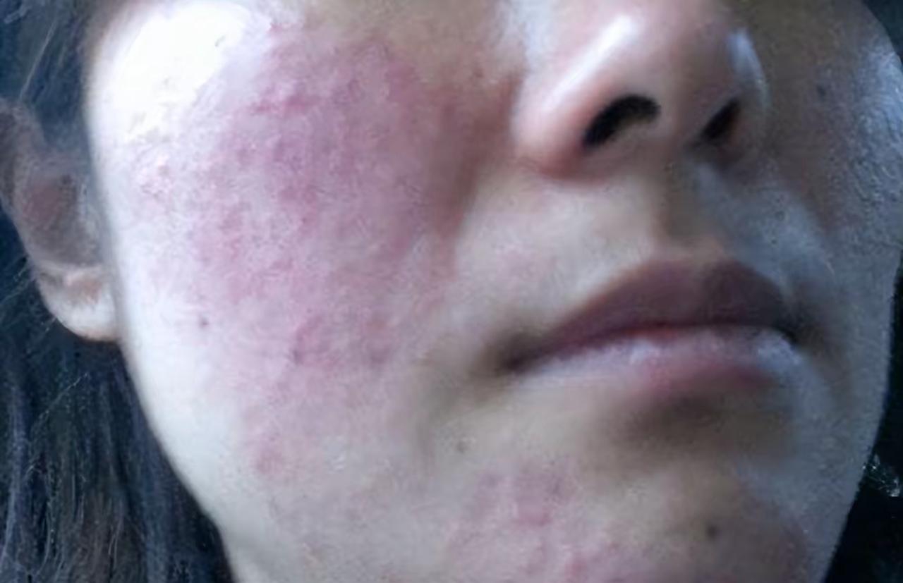 洗脸巾近90%藏“神经毒素”？央视曝光后我赶紧扔了囤货
 
央视最近曝了个大消息