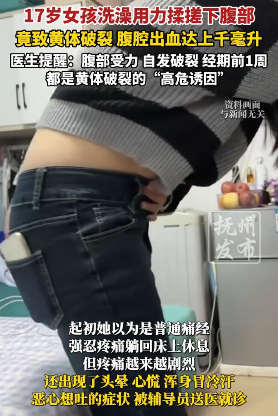 湖南，一17岁女孩回宿舍洗澡时，因用力搓腹后，感到腹部一阵撕裂样疼痛。起初女孩也