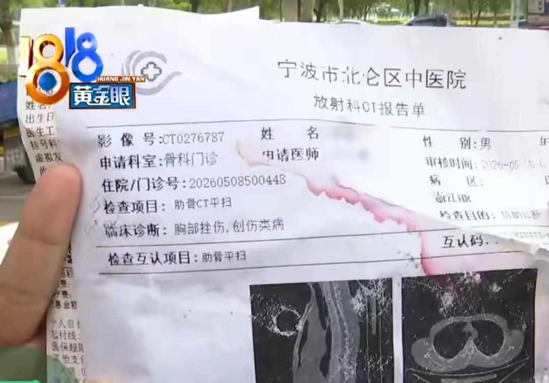 人到了中年再看宁波小伙踩背骨折这事儿，
蕞大的庆幸，
是他只断了一根肋骨，
没把